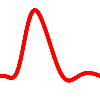 A pulse wave measured by photoplethysmography